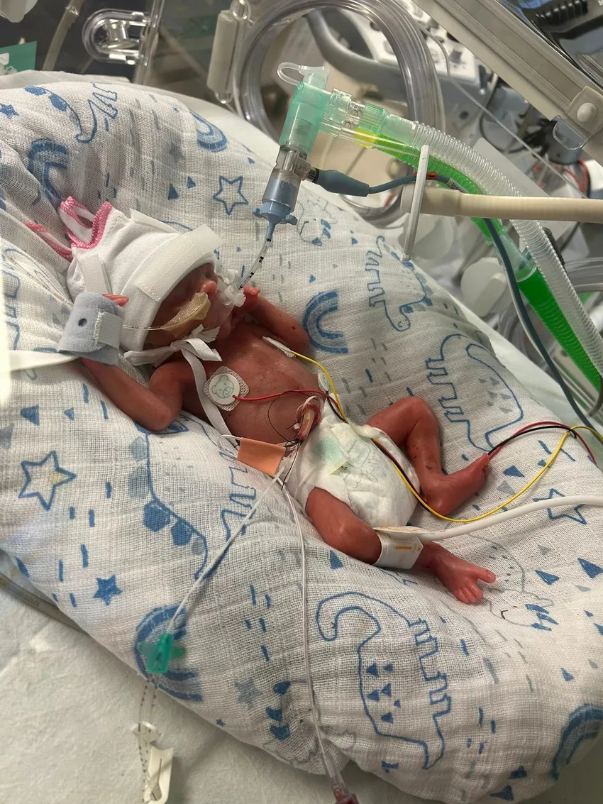 A neonatal baby