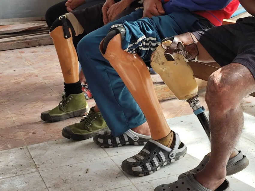Landmine victims Karenni State