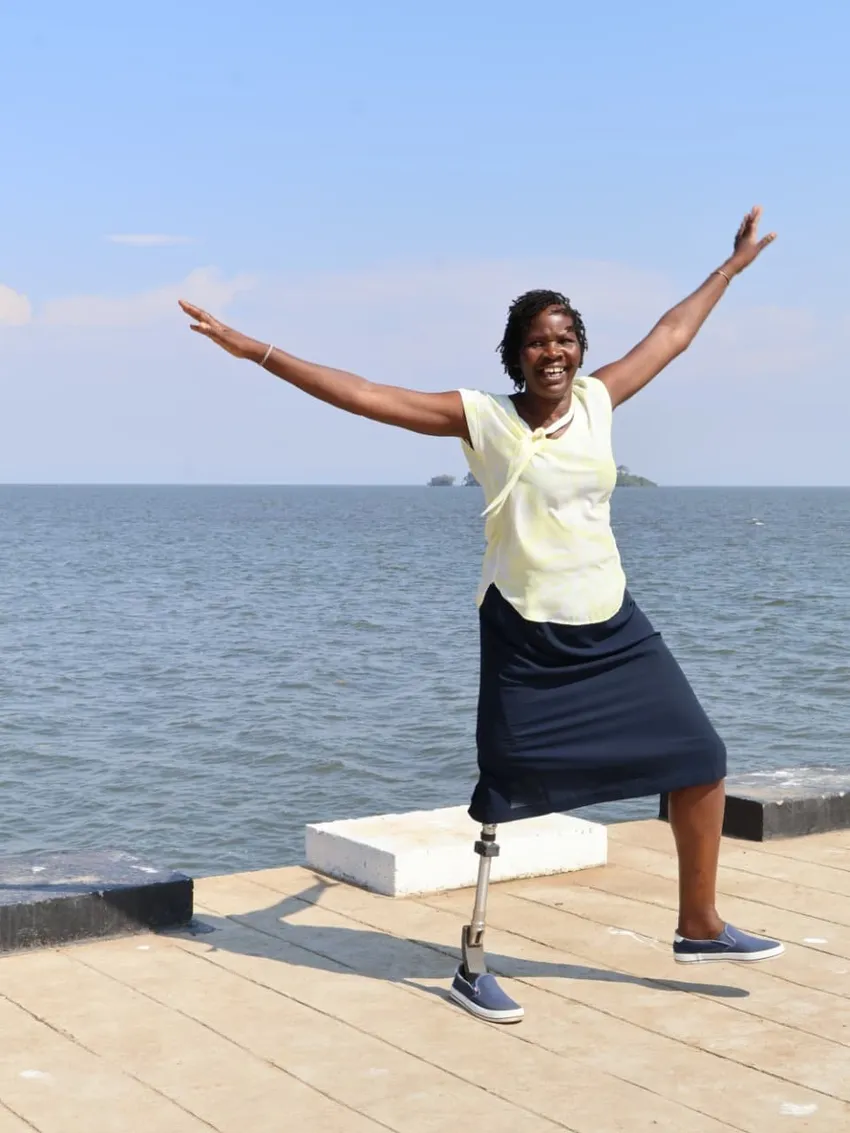 An amputee stands looking happy