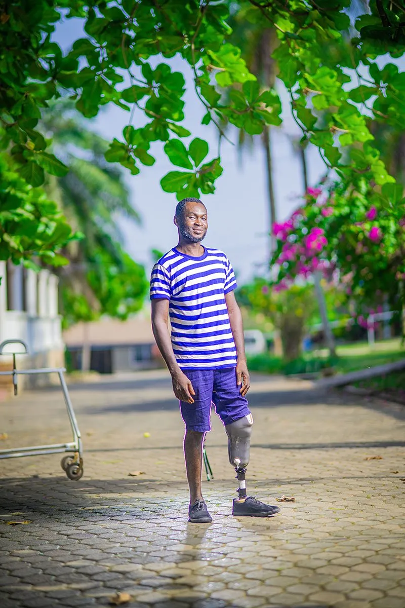 A happy looking man with a prosthetic leg