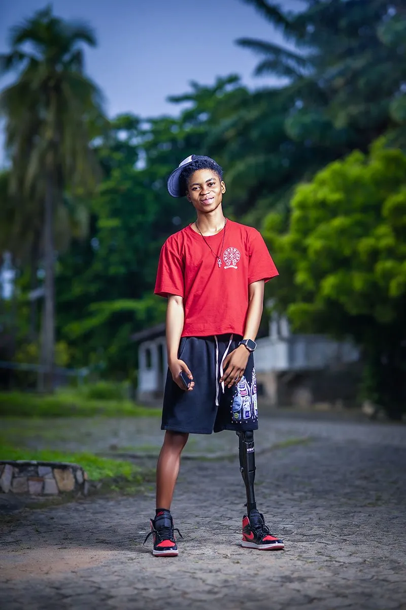 A young man with a hat and prosthetic leg