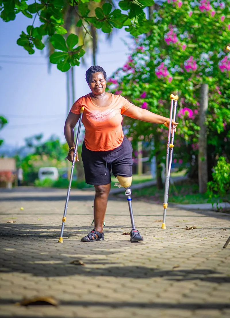 A lady with a prosthetic leg holding crutches