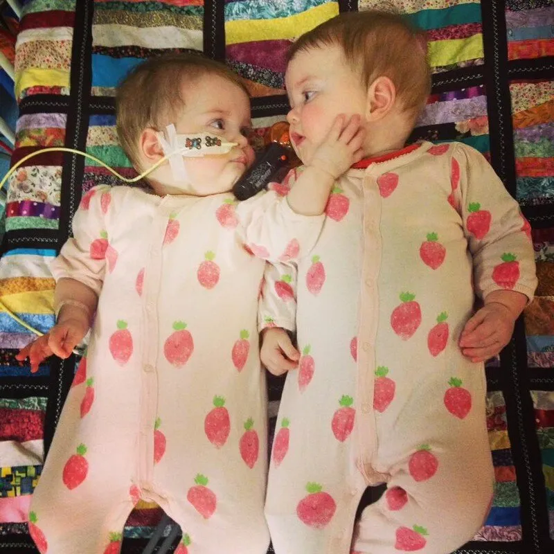 Aurora & Aurelia as babies