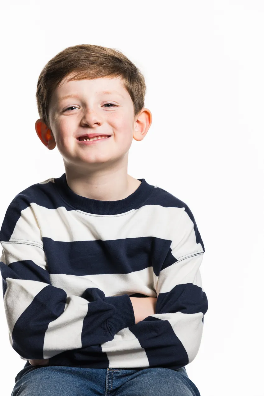 Theo, aged 6, was born with a cleft lip and palate