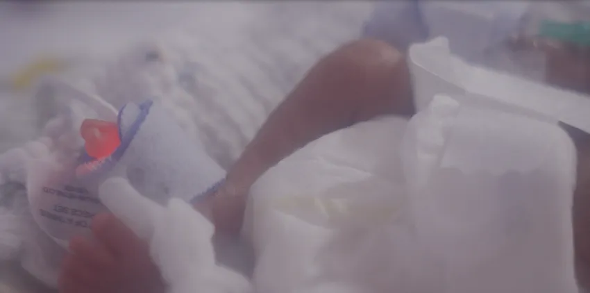 Picture of a neonatal babies foot
